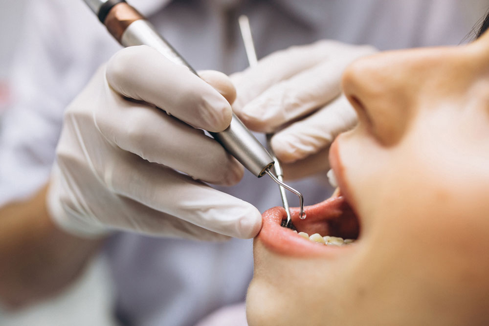 Perawatan Gigi yang Ditanggung BPJS Kesehatan